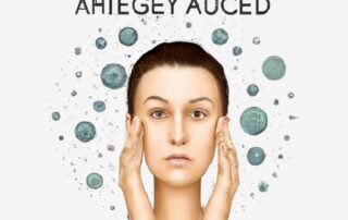 Understanding and Treating Adult Acne